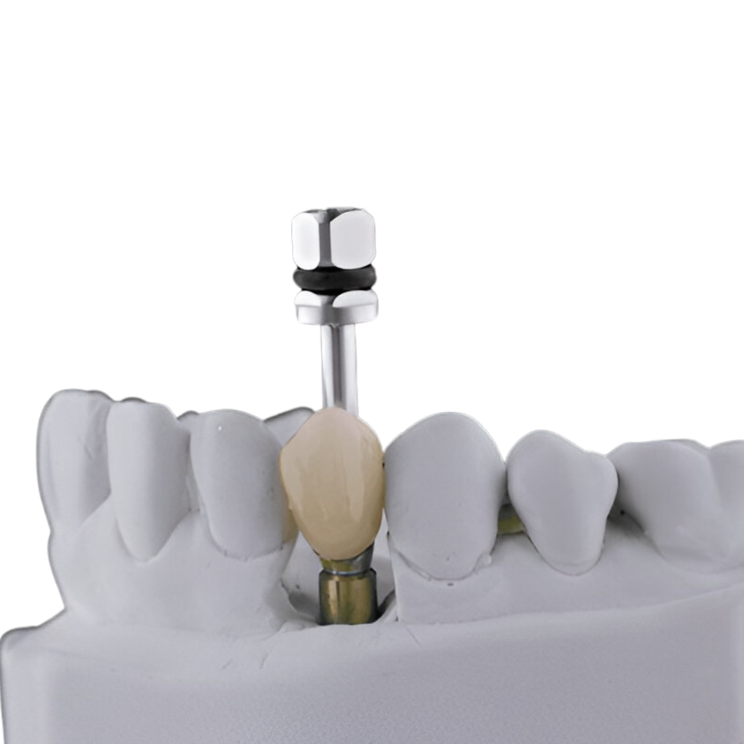 Best Dental Hospital in Chennai