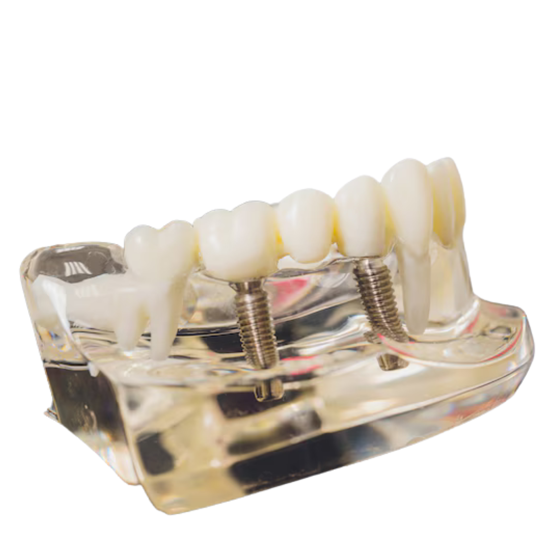 Best Dental Hospital in Chennai