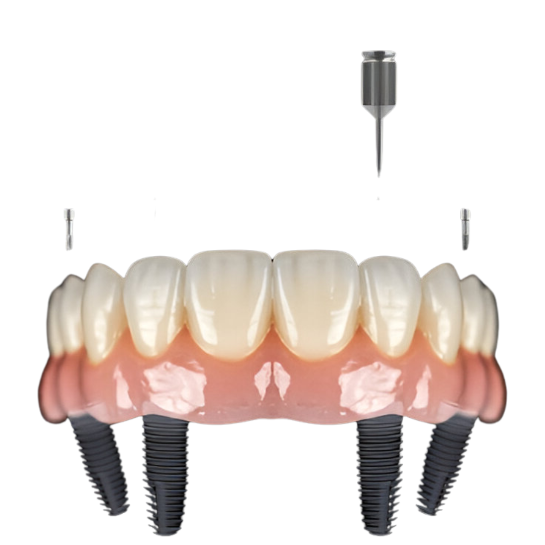 Best Dental Hospital in Chennai