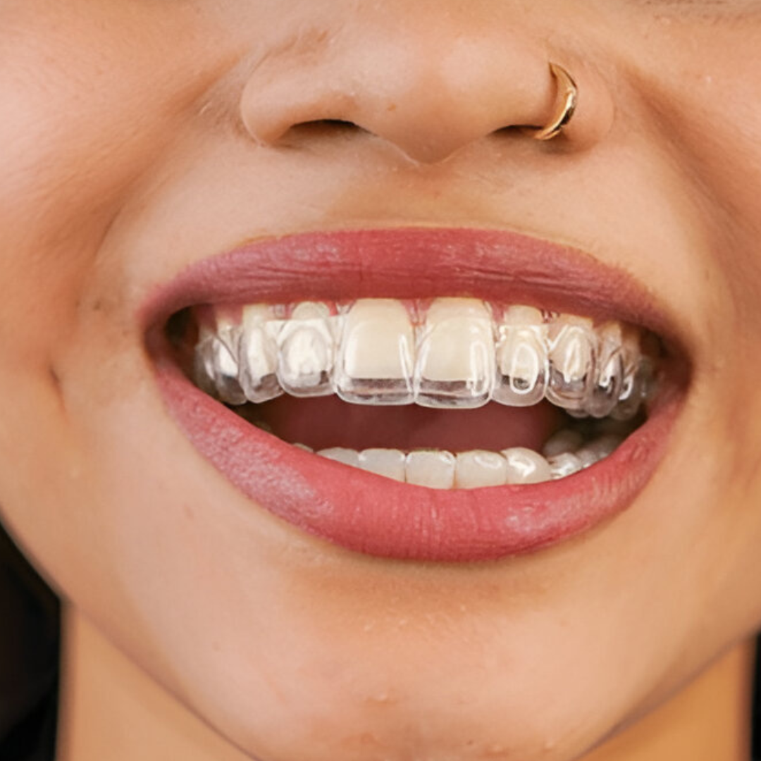 Comfortable Invisalign