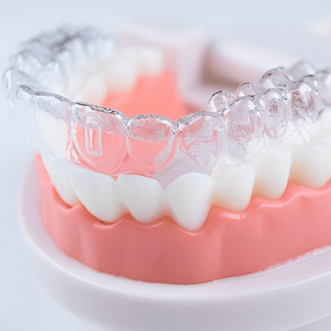 invisalign treatment in chennai