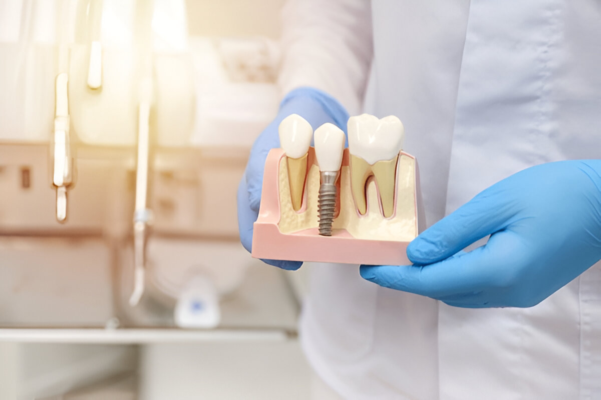 Best Dental Hospital in Chennai