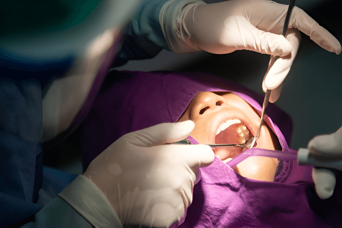 pediatric dentistry​ in chennai