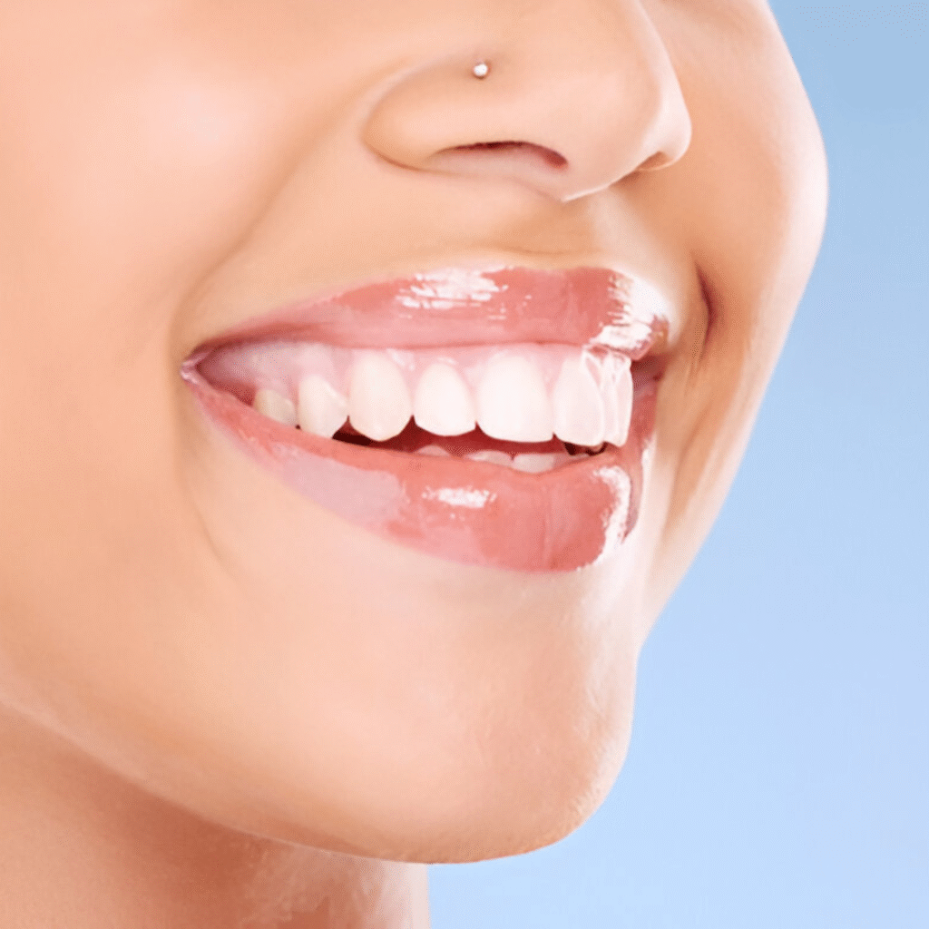 invisalign treatment in chennai