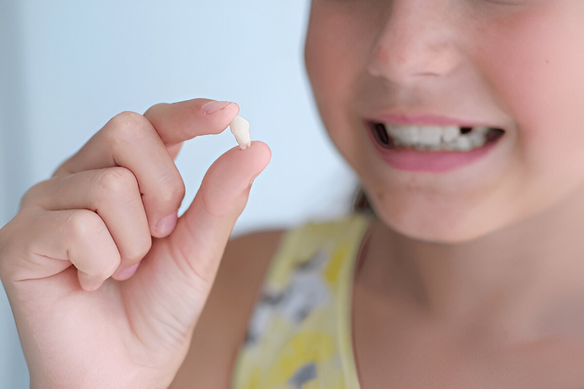 pediatric dentistry​ in Chennai