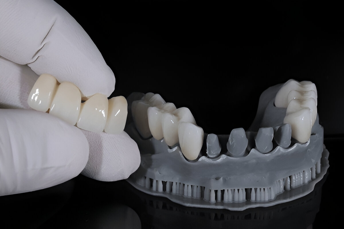 dental implants near me