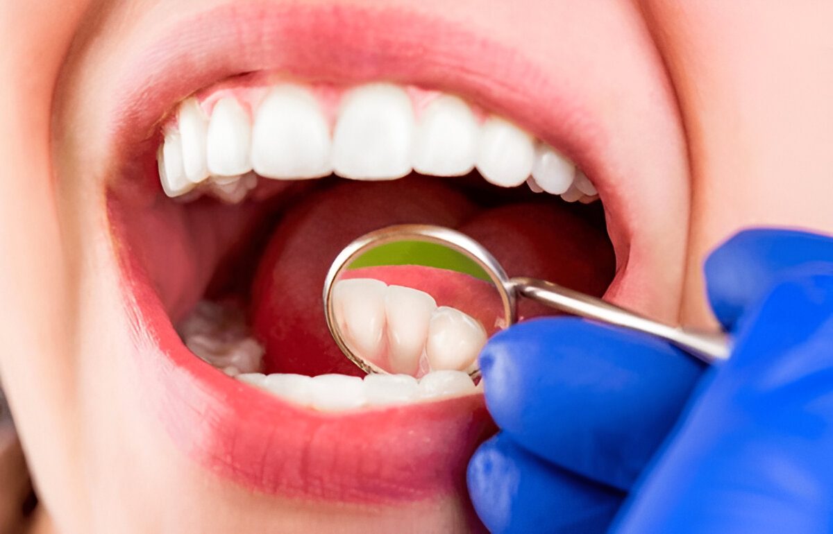 pediatric dentistry​ in Chennai