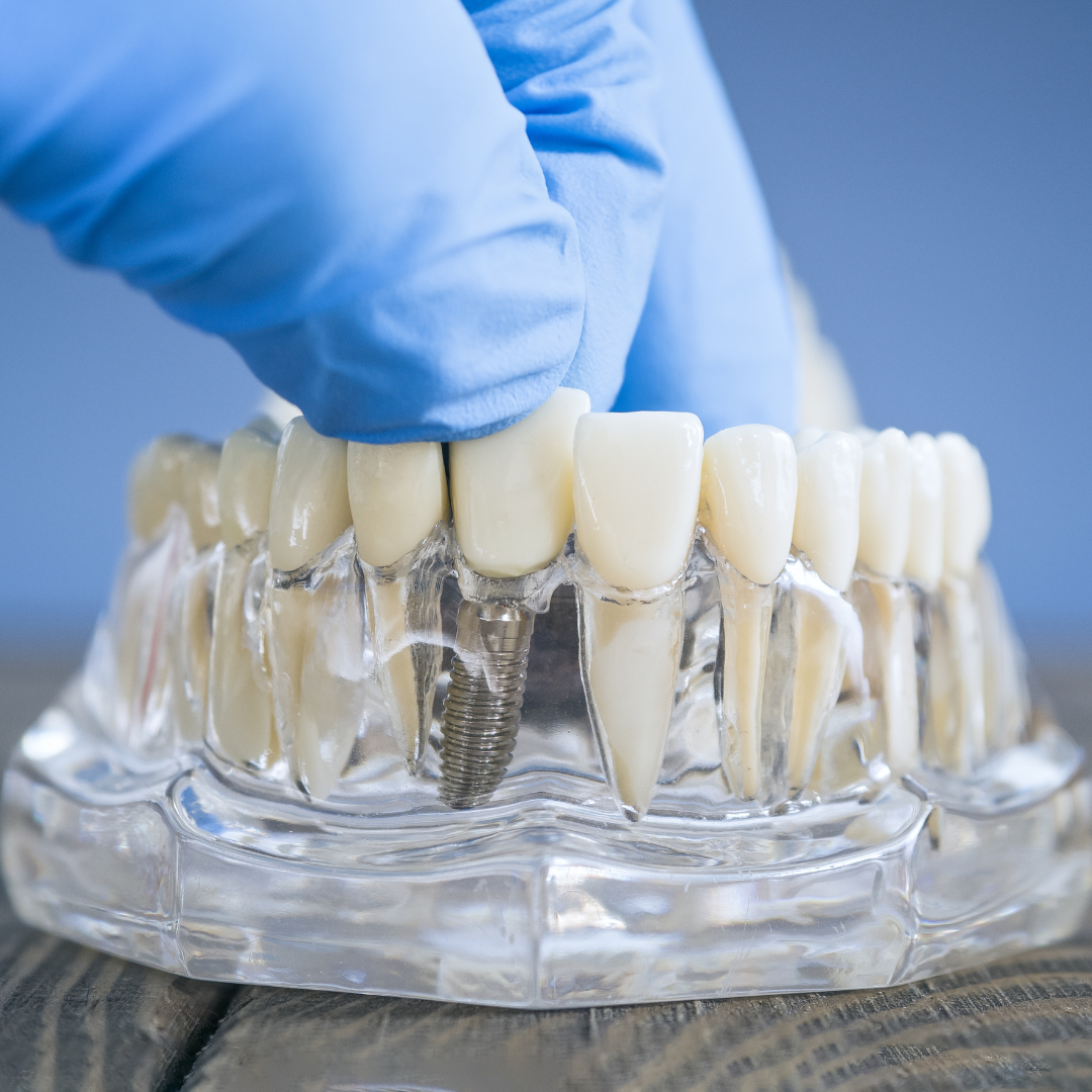 Dental Care