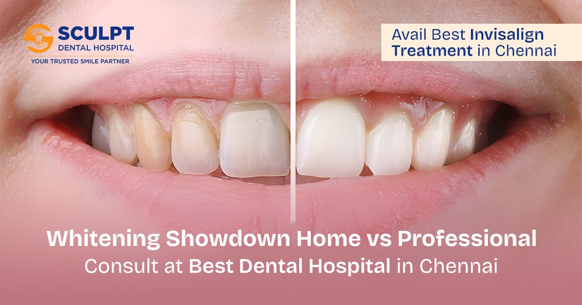 Best Dental Hospital in Chennai