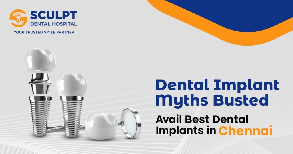 Dental Implant Myths That Patients Still Believe