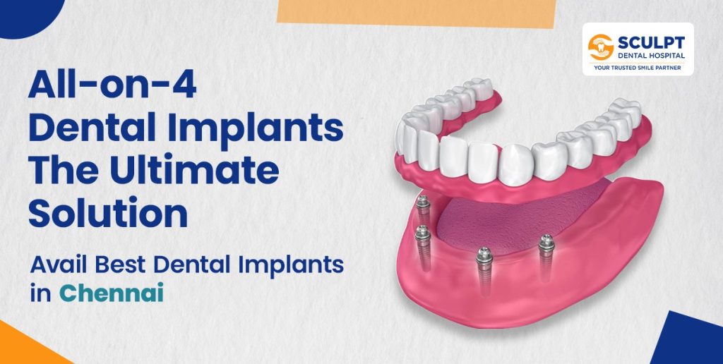 All-on-4 Dental Implants: The Ultimate Solution for Missing Teeth
