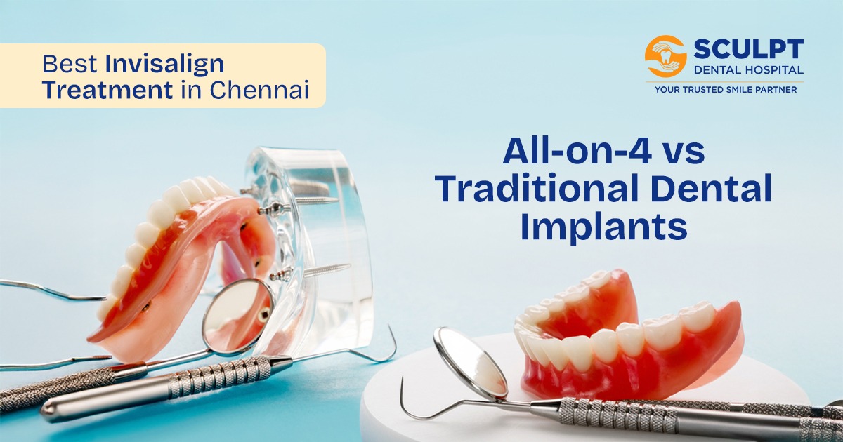 Best Dental Implants in Chennai