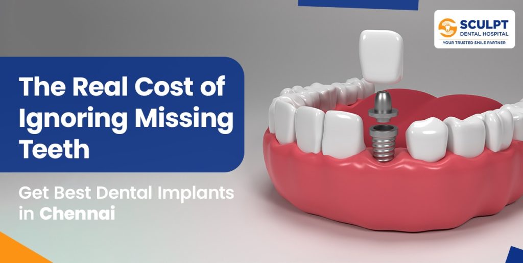 The Cost of Not Replacing Missing Teeth