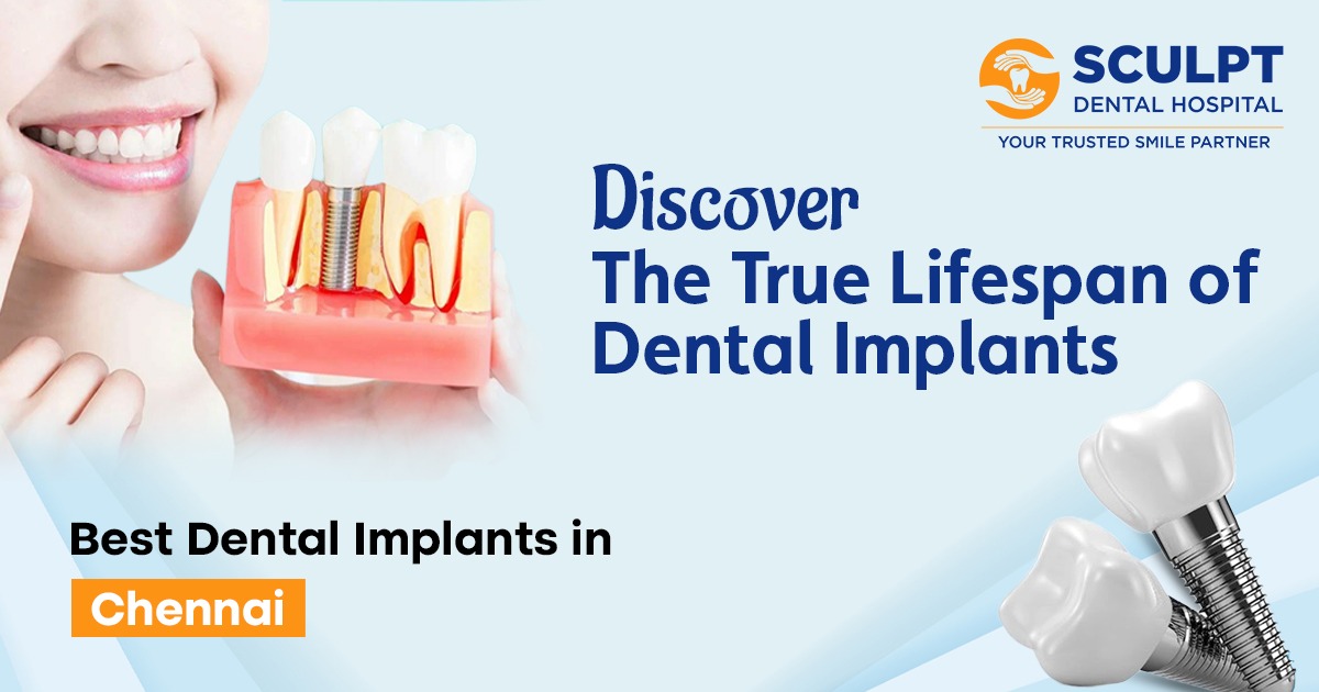 Best Dental Implants in Chennai