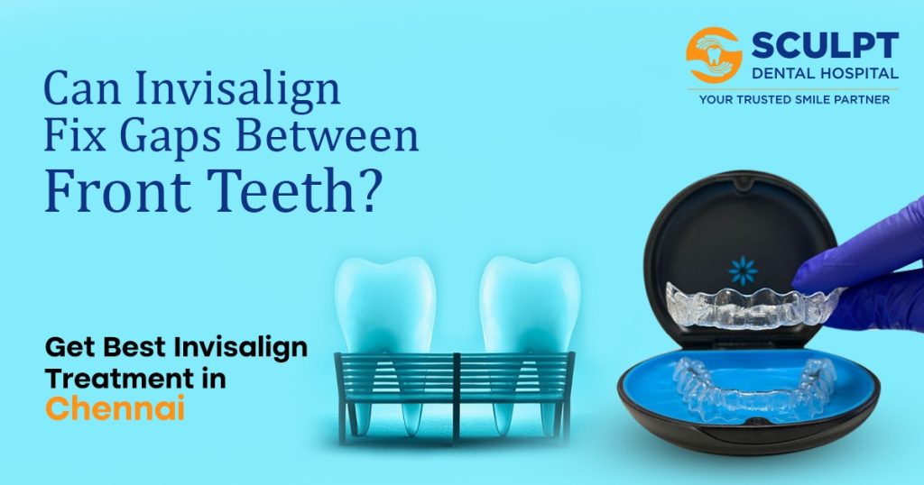 Can Invisalign Fix Gaps Between Front Teeth?
