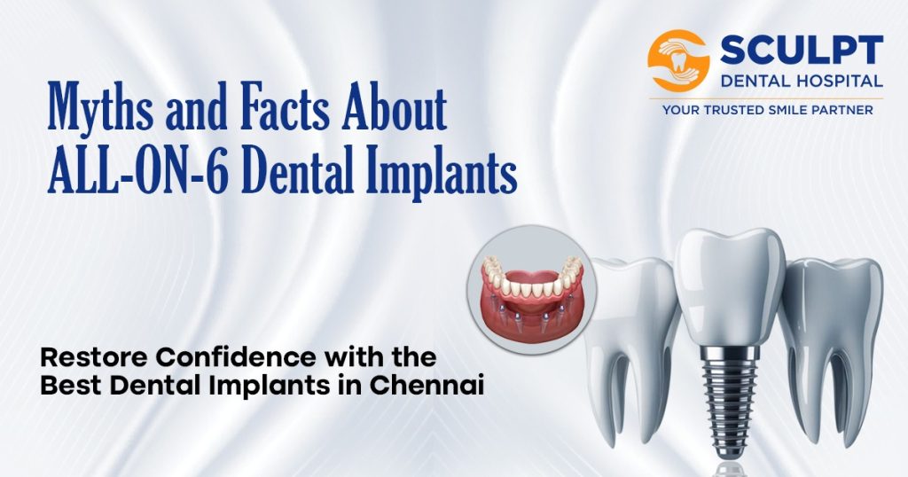 Myths and Facts About All-on-6 Dental Implants