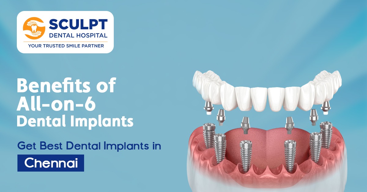 Best Dental Implants in Chennai
