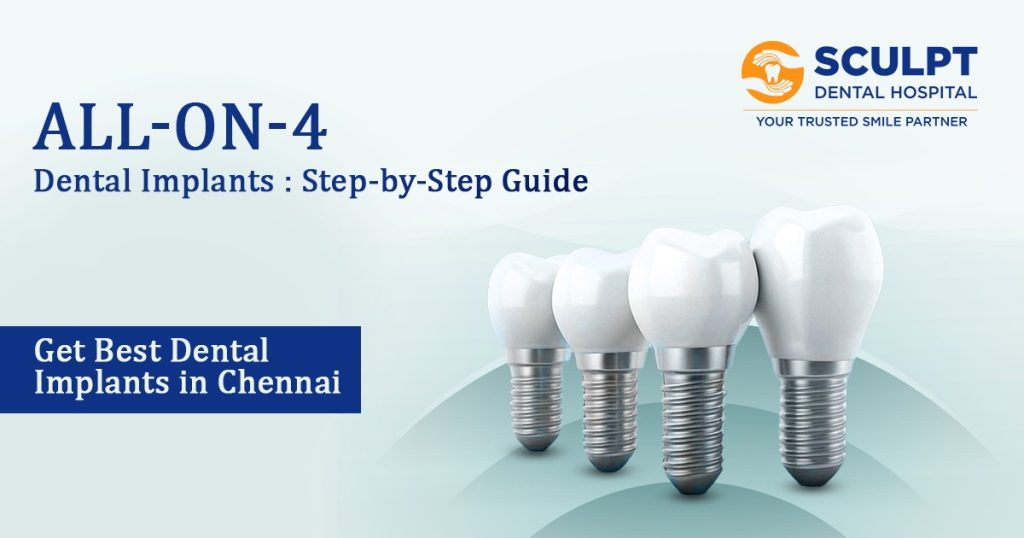 Best Dental Implants in Chennai