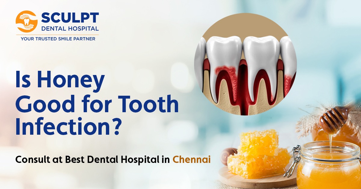 Best Dental Hospital in Chennai