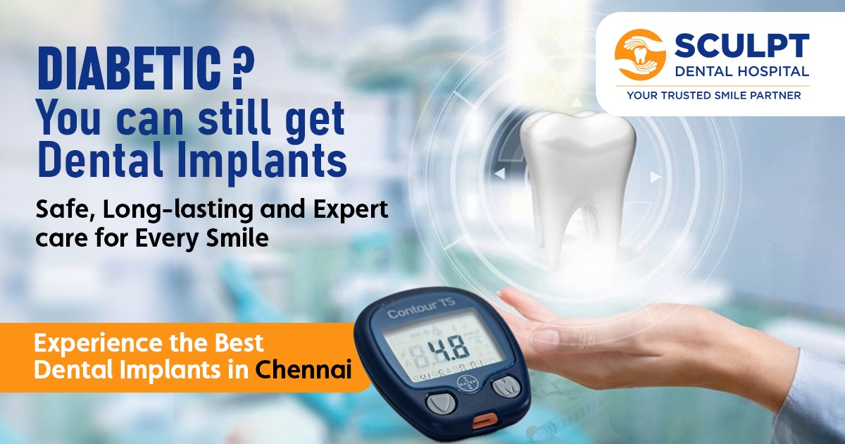 Best Dental Implants in Chennai