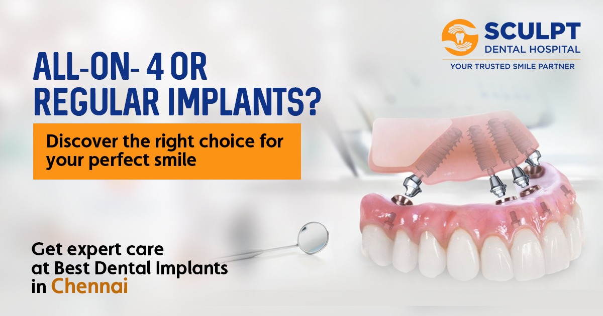 Best Dental Implants in Chennai