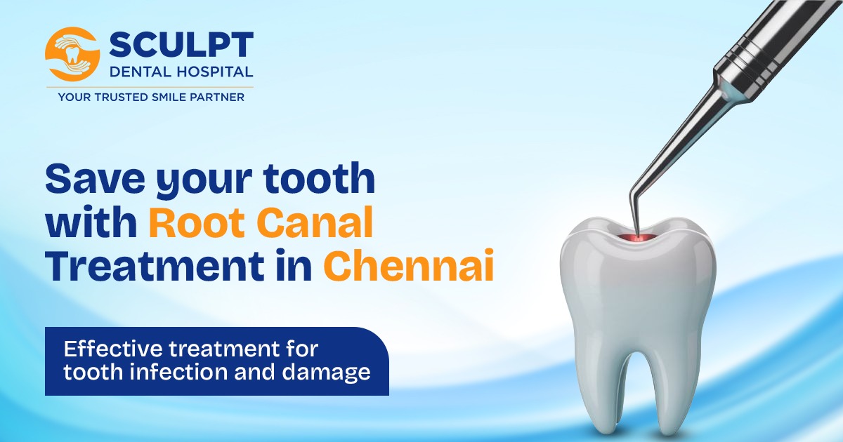 Root Canal Treatment in Chennai