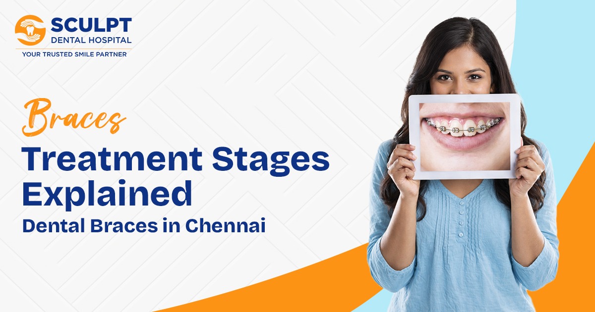 Dental Braces in Chennai