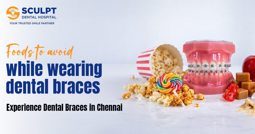 What Foods Should I Avoid With Braces?