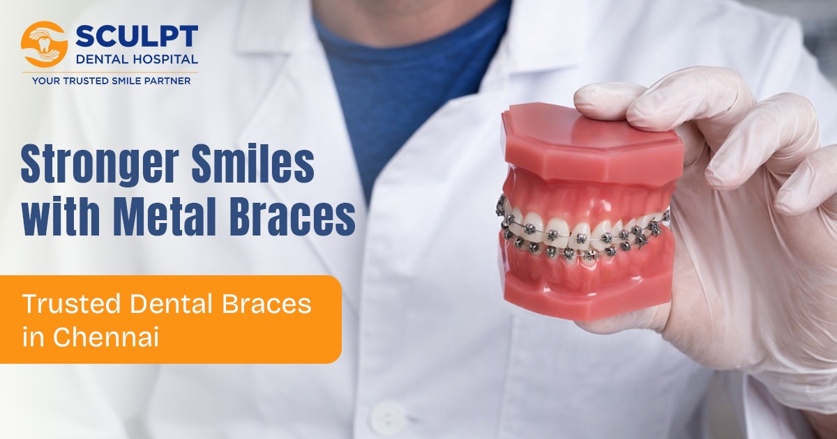 Dental Braces in Chennai
