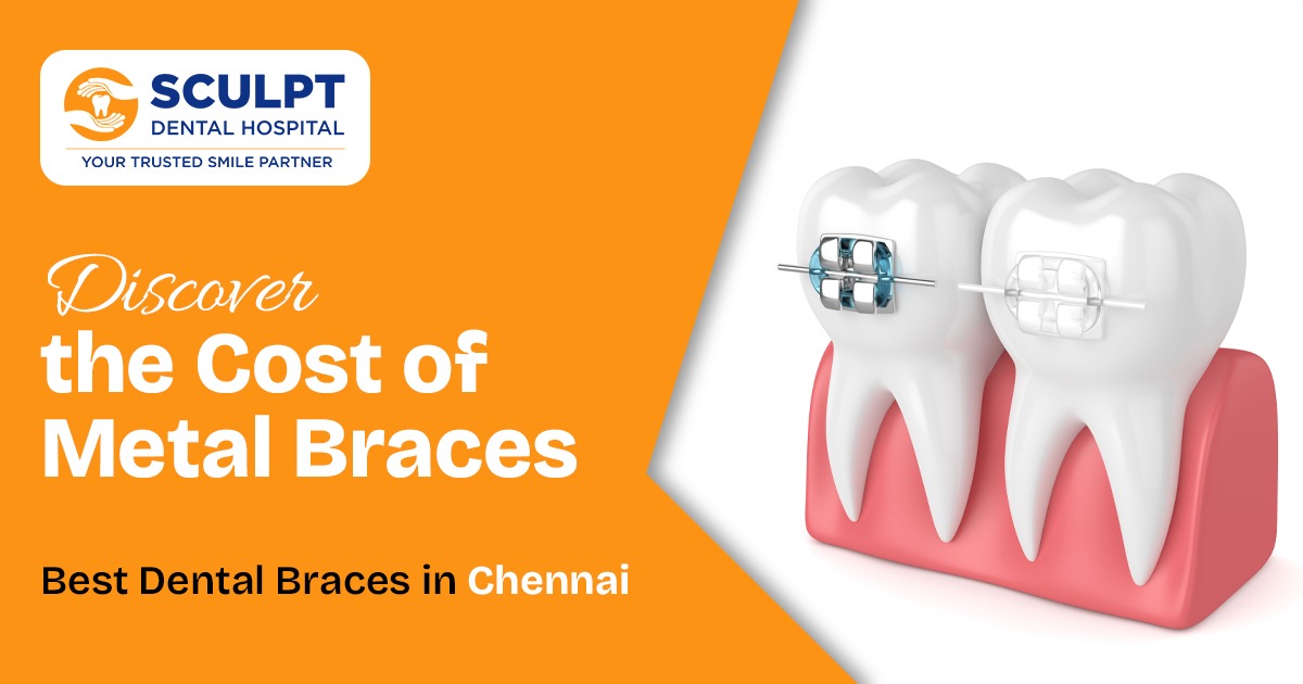 Dental Braces in Chennai