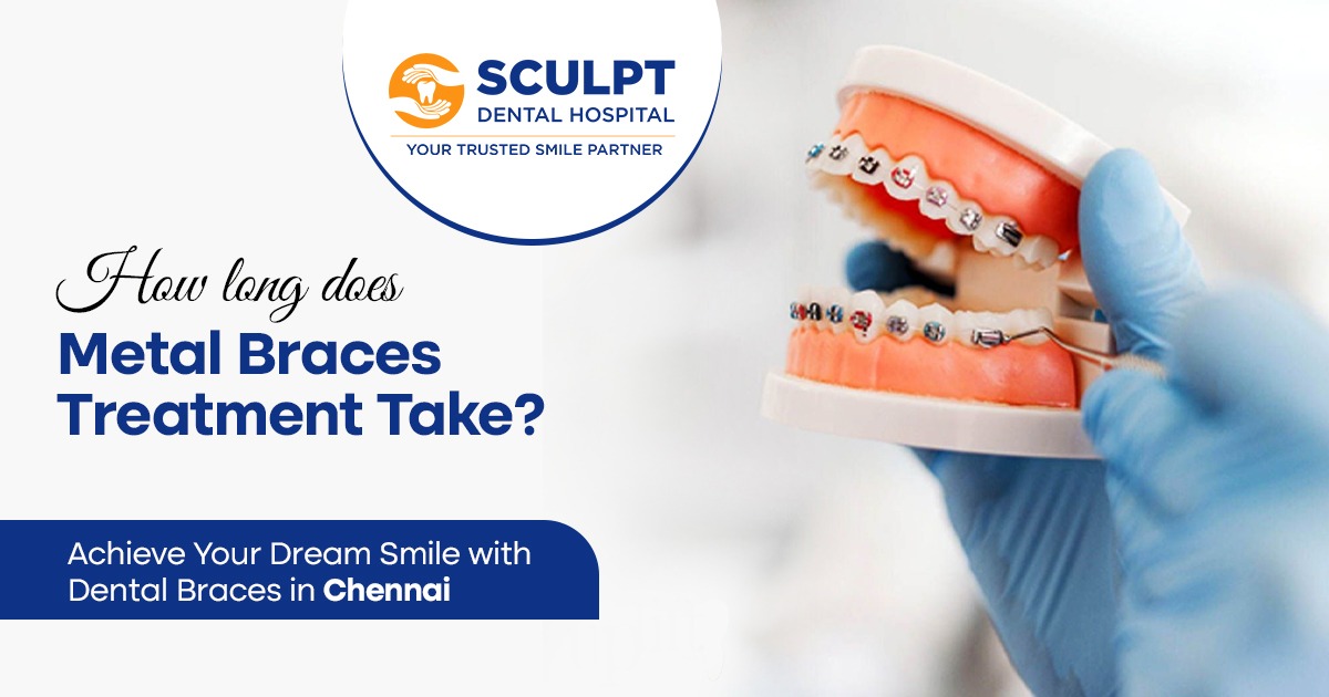Dental Braces in Chennai