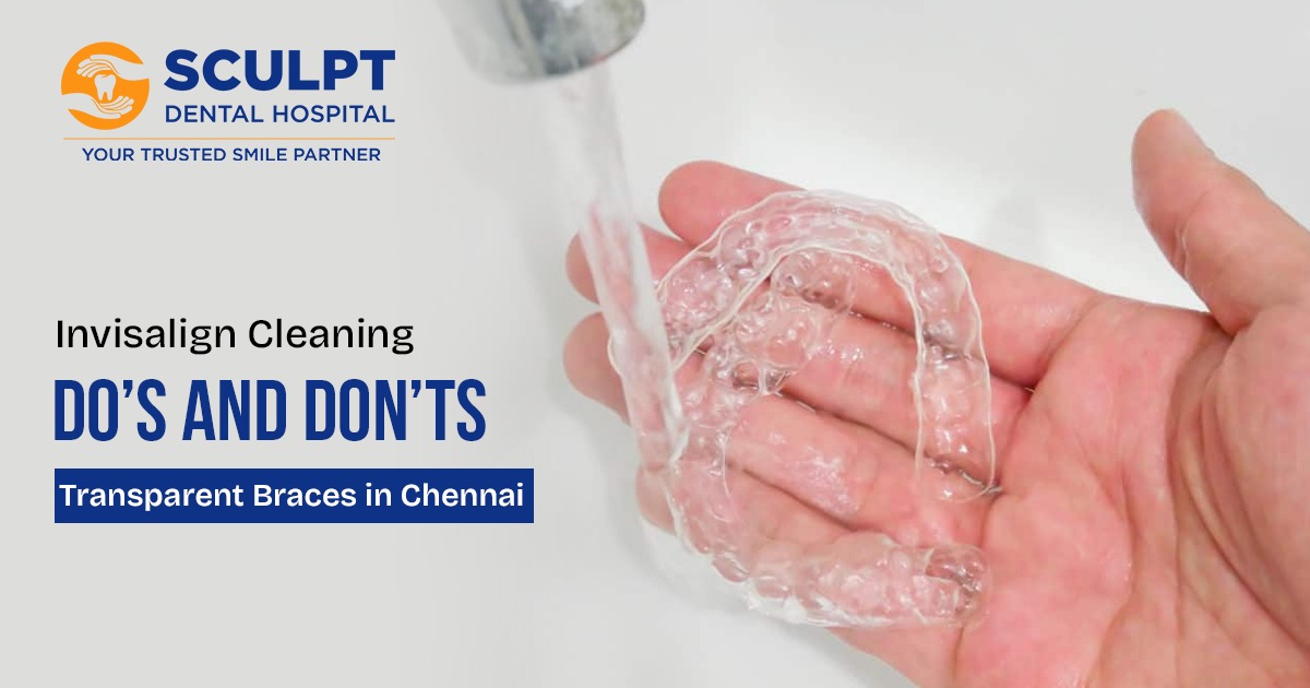 Transparent Braces​ in Chennai