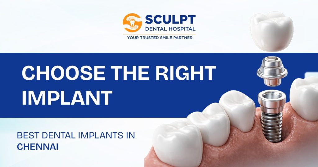 Best Dental Implants in Chennai