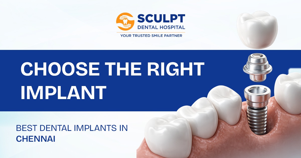 Best Dental Implants in Chennai