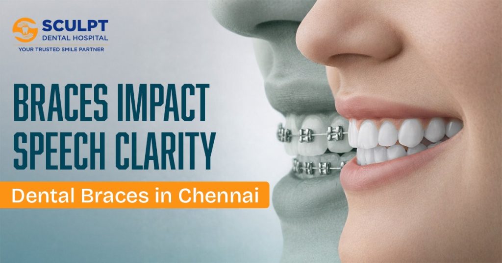 Dental Braces in Chennai