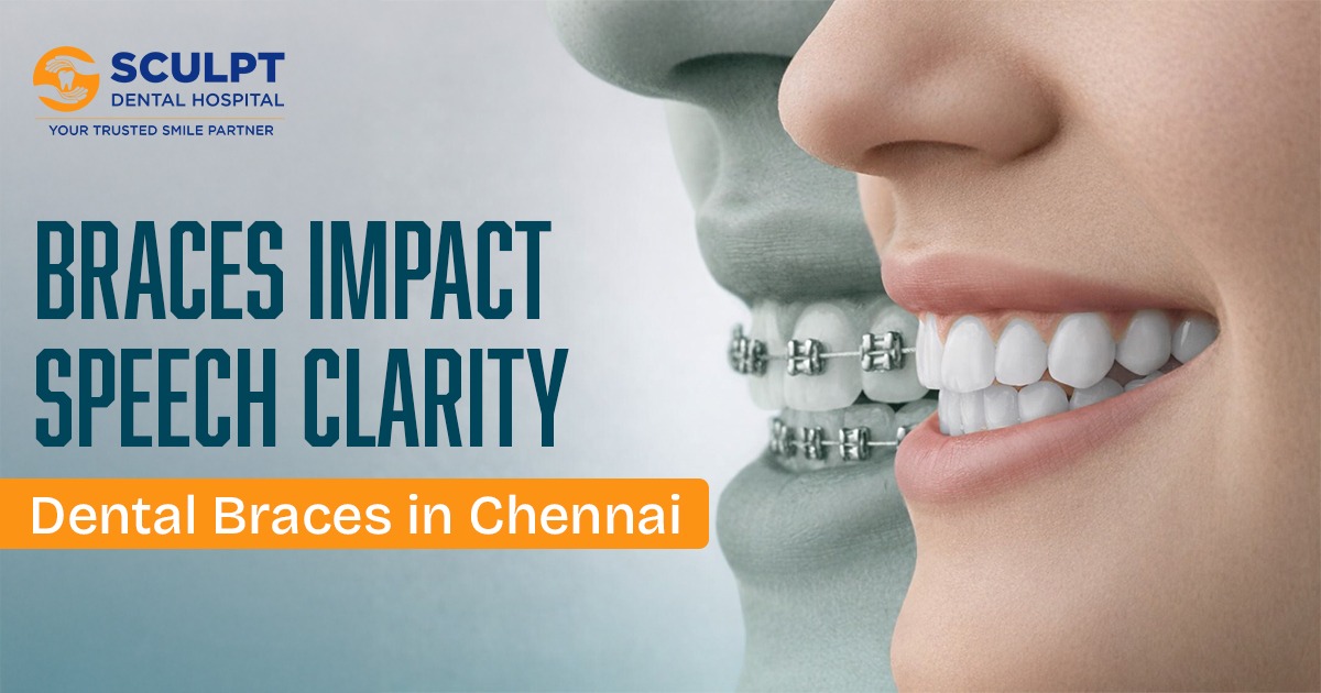 Dental Braces in Chennai
