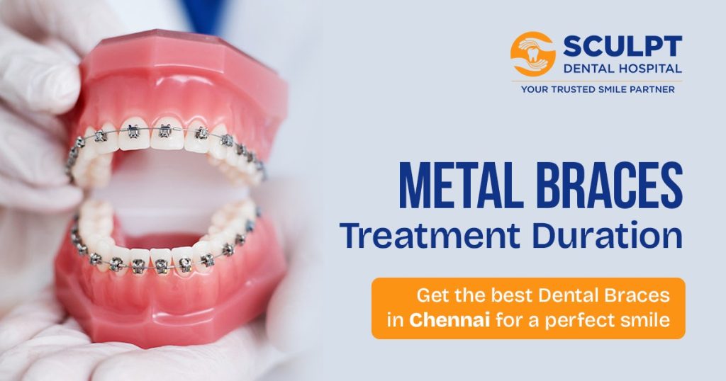 Dental Braces in Chennai