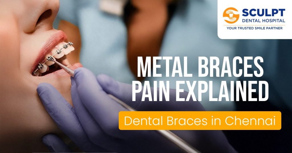 Dental Braces in Chennai