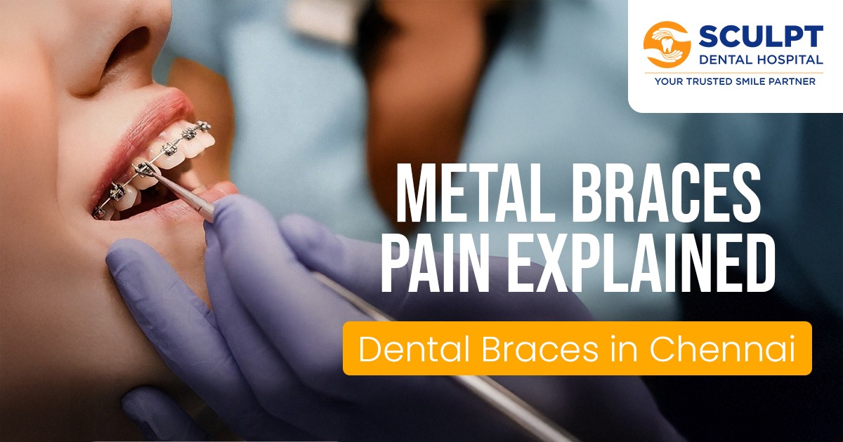 Dental Braces in Chennai