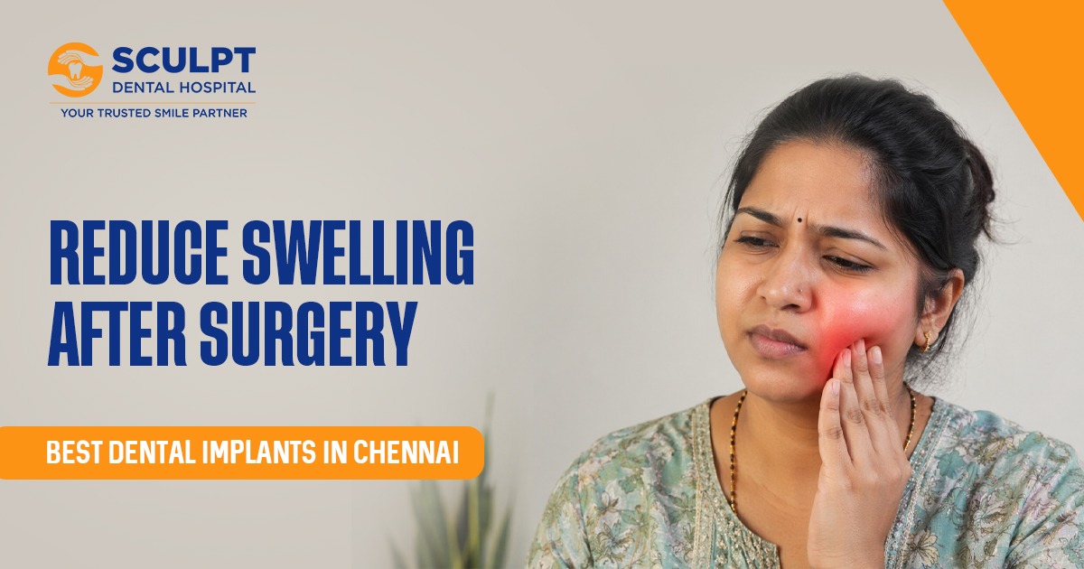 Best Dental Implants in Chennai