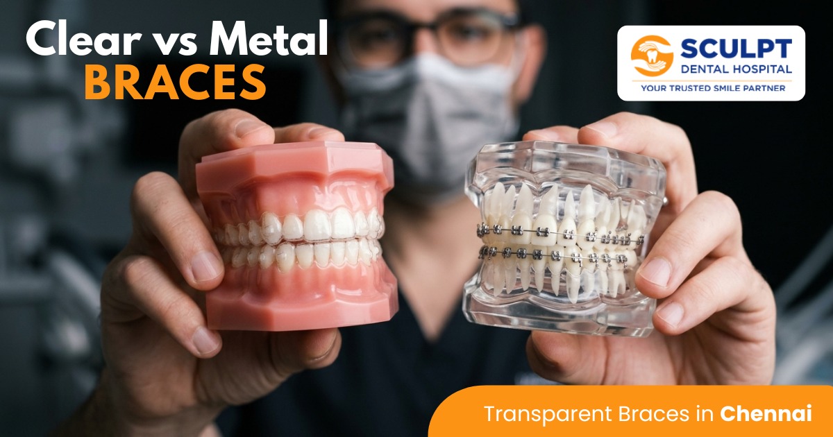 Transparent Braces​ in Chennai