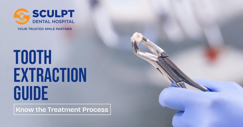How Much Does It Cost to Remove a Tooth in Chennai?
